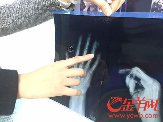 С�^�������ĊA��ָ����С��ָ�Ǳ��A���� 