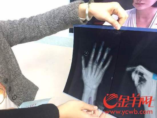 С�^�������ĊA��ָ����С��ָ�Ǳ��A���� 